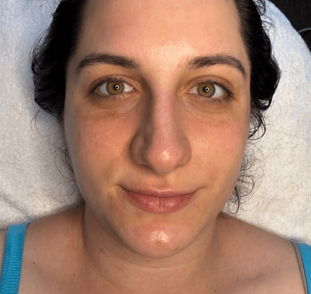 Organic Renewal After Oyster Bay