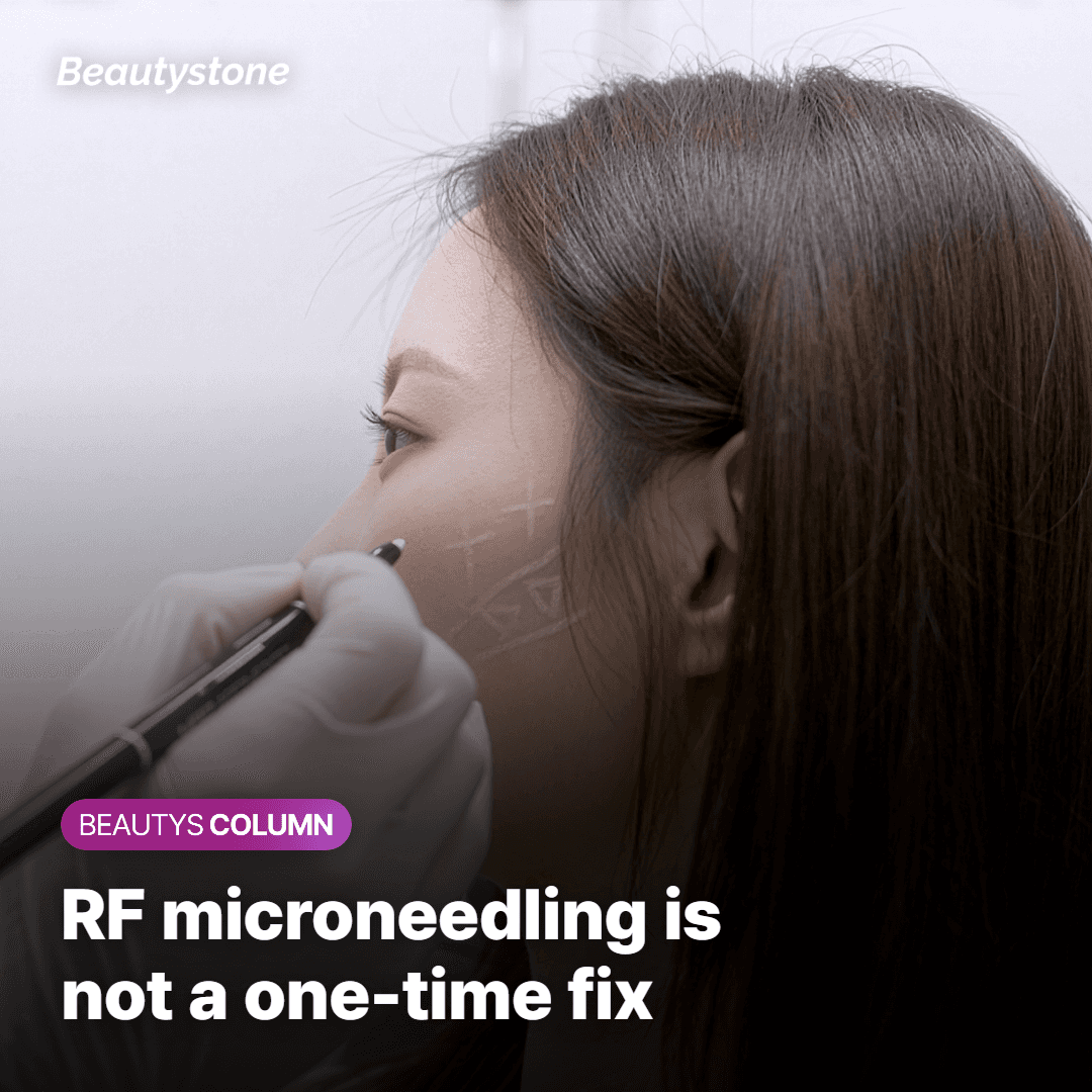 Potenza is RF Microneedling—It's not designed as a one-time fix
