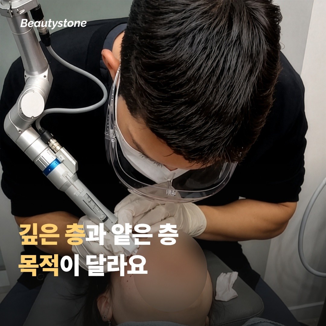 깊은 층과 얕은 층, 목적이 서로 달라요
