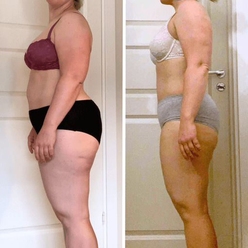 Före- och efterjämförelse av en kvinna som gick ner i vikt med RE:YOU-programmet