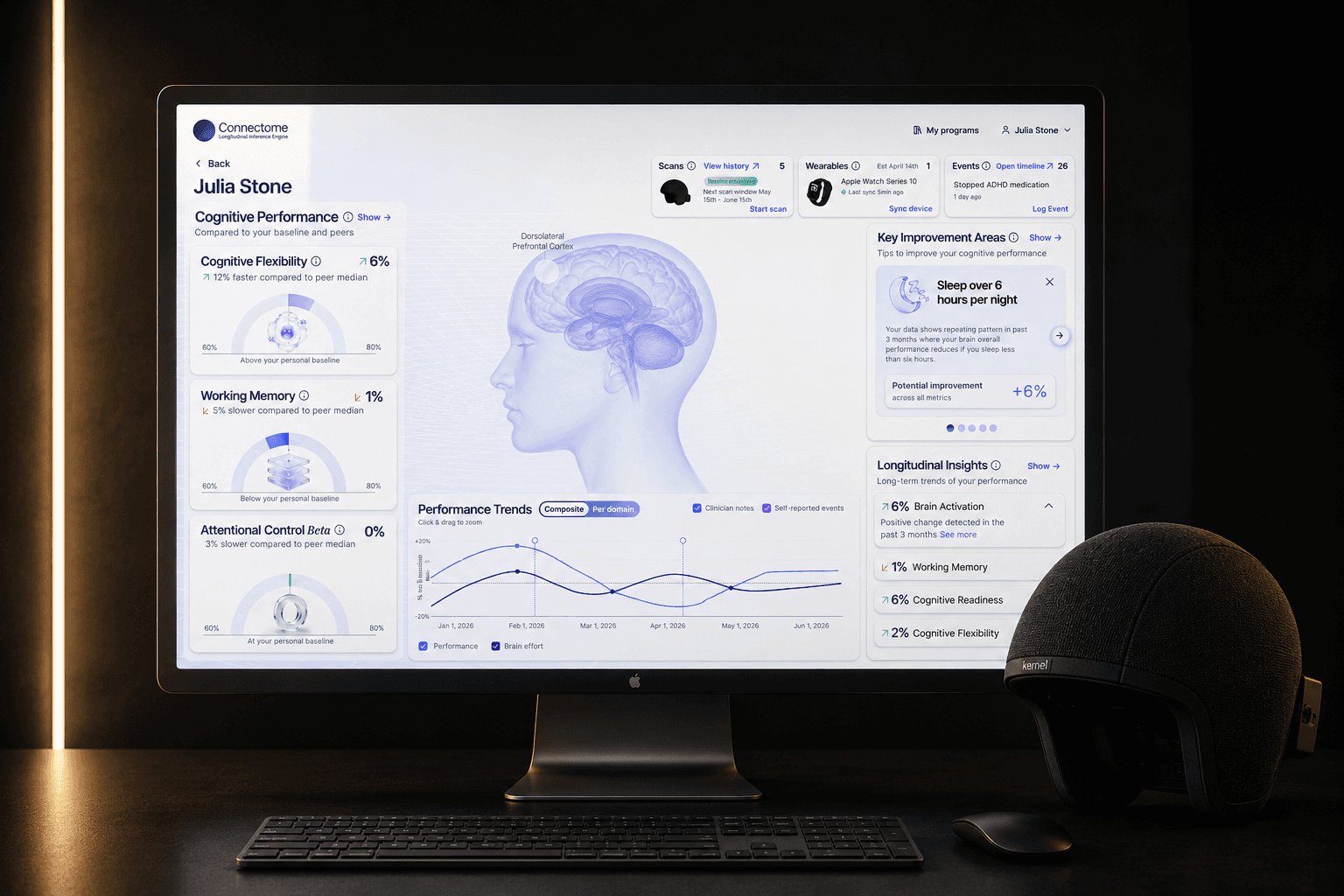 Connectome — cognitive intelligence
