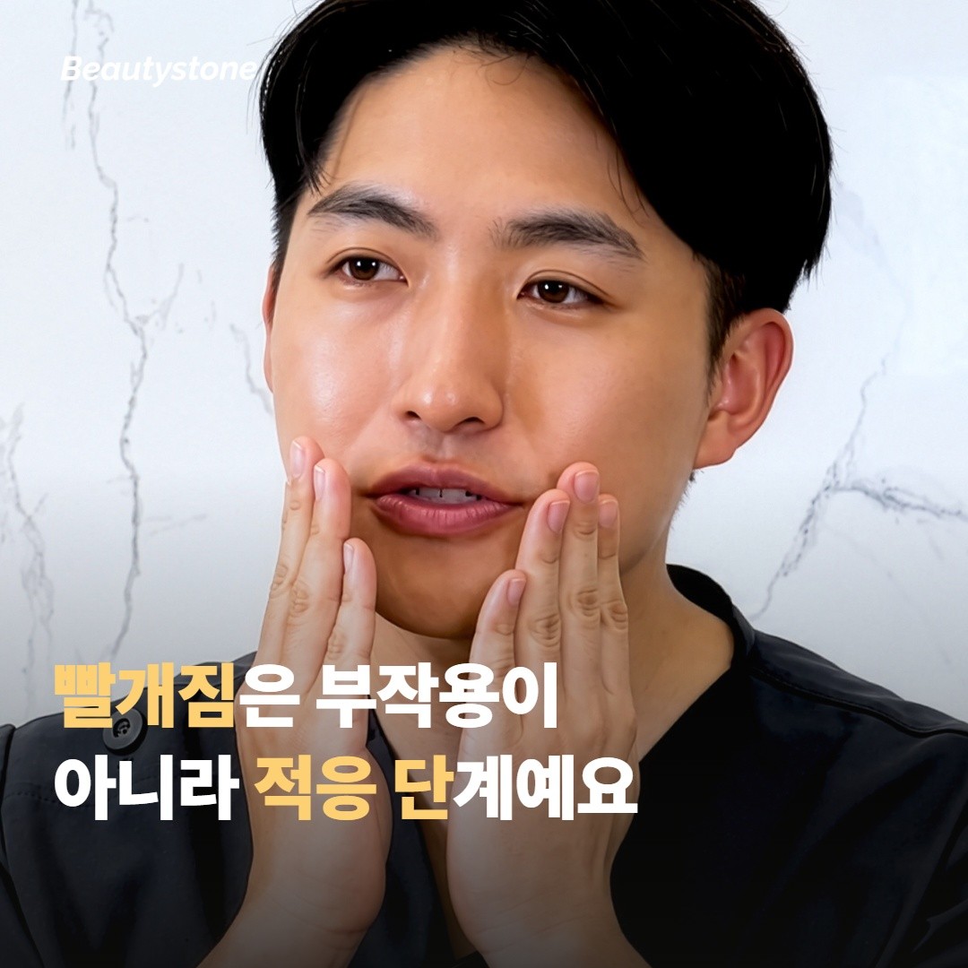 “빨개지고 따가운 건 부작용 아닌가요?”
