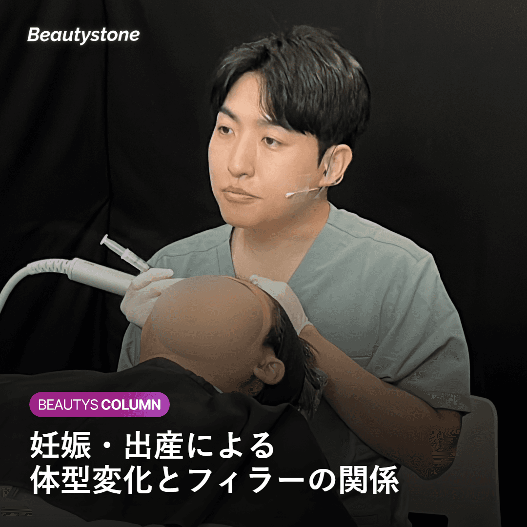 妊娠・出産による体型変化とフィラーへの影響の説明図