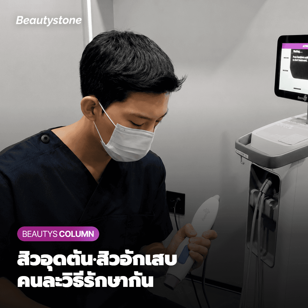 [รายงานจาก Beautystone] จะรักษาแผลเป็นสิวกับรอยดำพร้อมกัน ต้องออกแบบแผนการรักษาให้ต่างจากเดิม