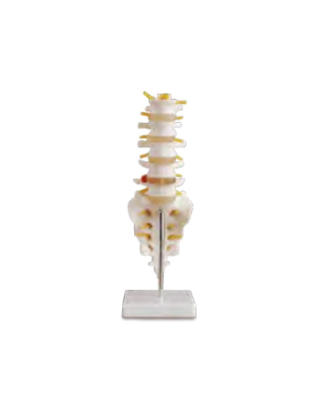 Life-size Lumbar Vertebra with Sacrum & Coccyx and Herniated Disc