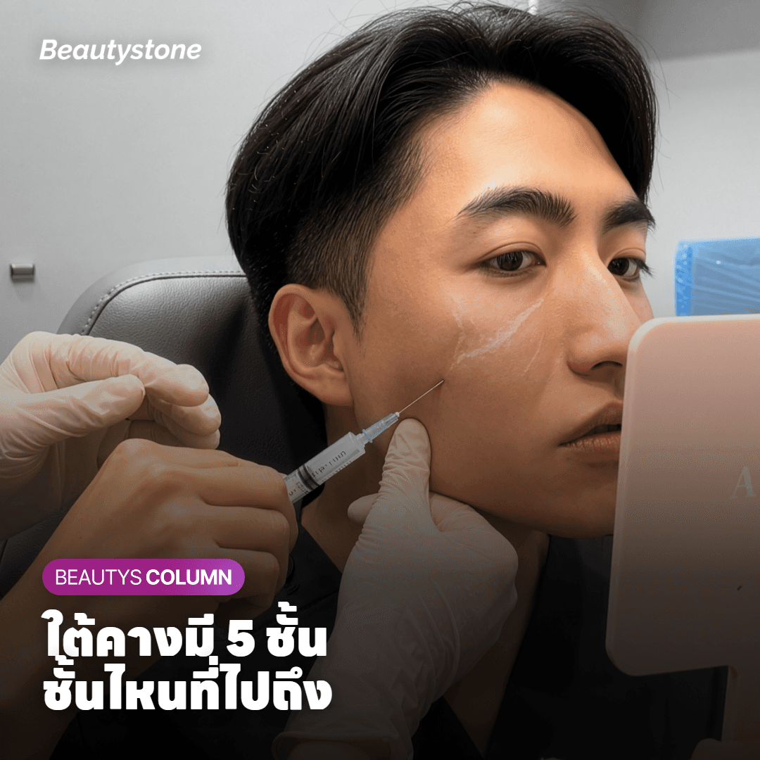 ภาพแสดง 5 ชั้นใต้คางตั้งแต่ผิวหนังถึงกระดูกไฮออยด์