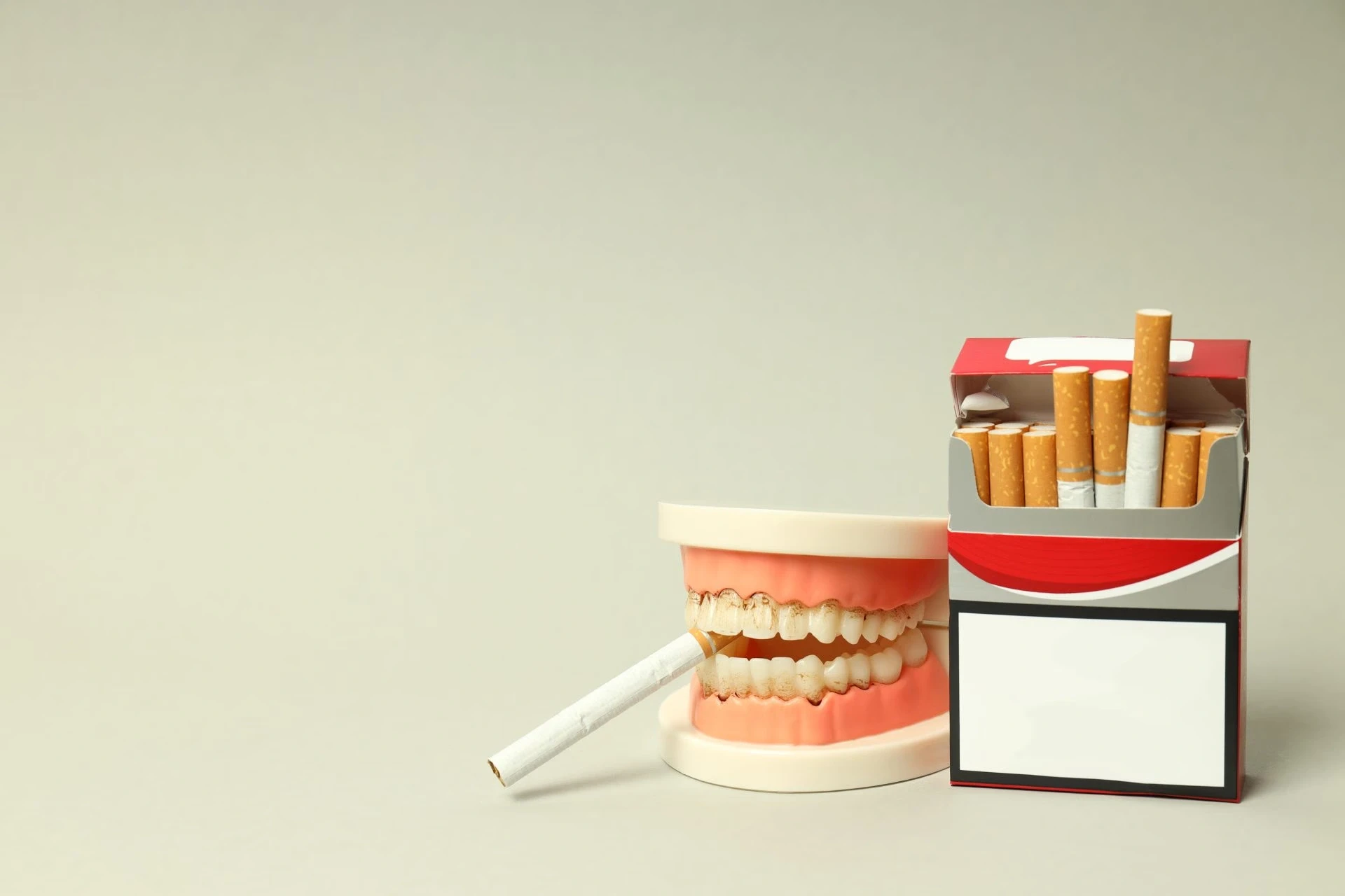 dental implants failure