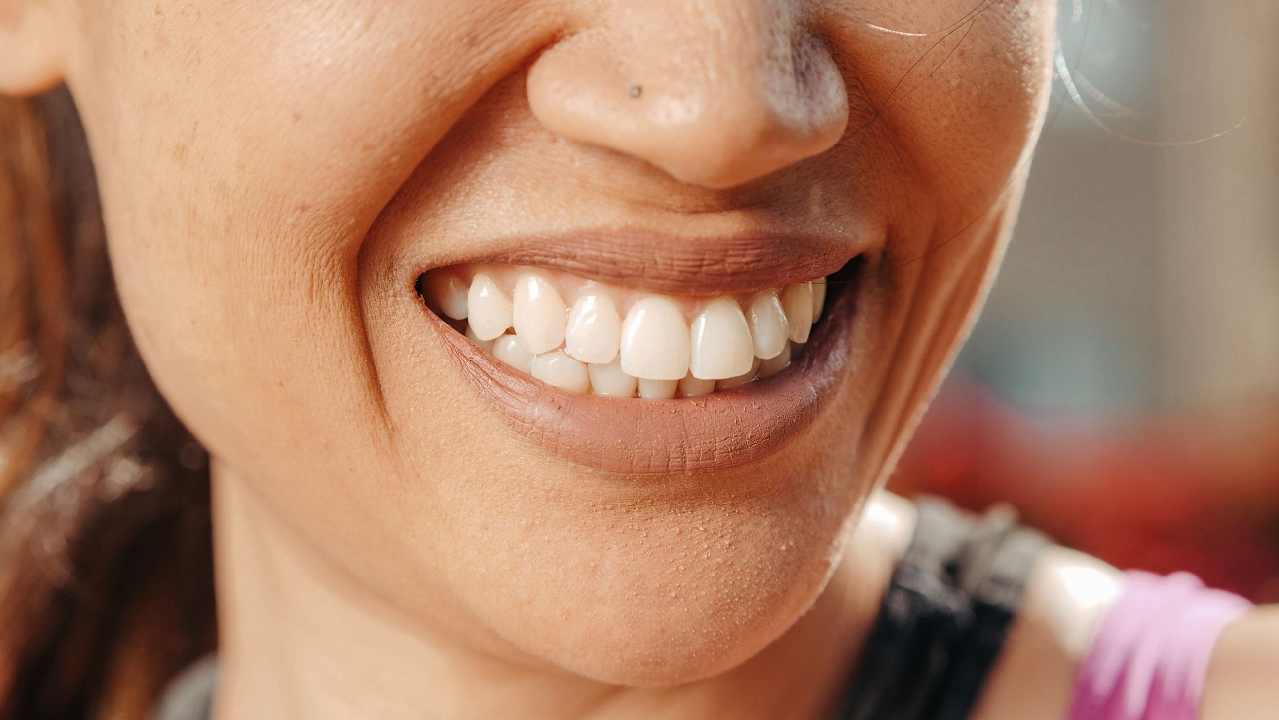 a young woman smiling showing teeth
