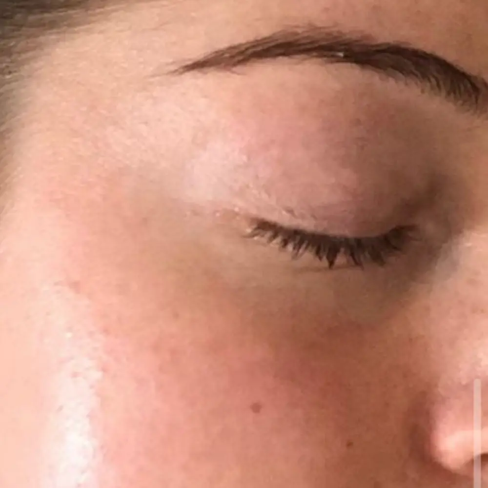 After barrier repair enzyme facial at The Vancouver Aesthetician — skin barrier restored, fine lines visibly softened and complexion deeply hydrated and healthy
