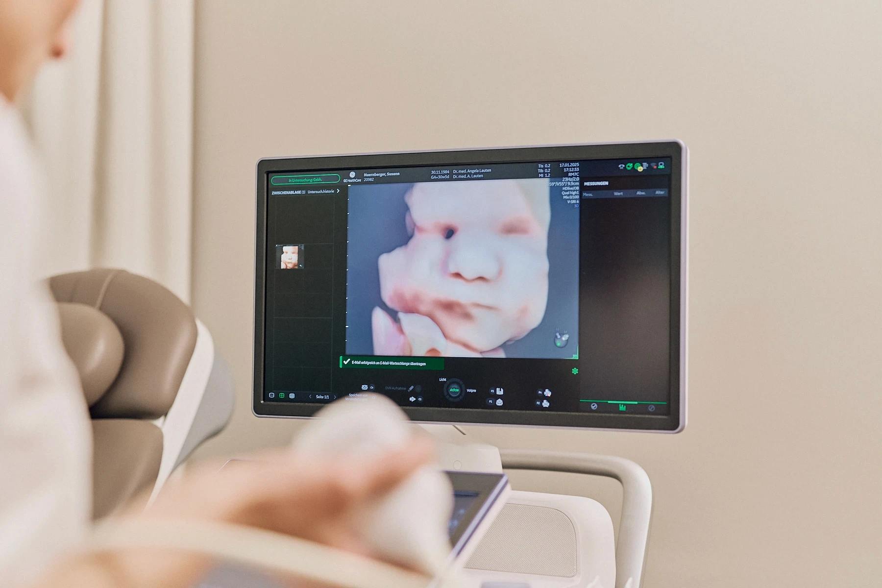 3D-Ultraschall-Bild eines ungeborenen Babys in der Praxis Dr. med. Angela Lauten in Erfurt, spezialisiert auf Pränataldiagnostik, Feindiagnostik, Pränatalmedizin, Frauenheilkunde und Gynäkologie