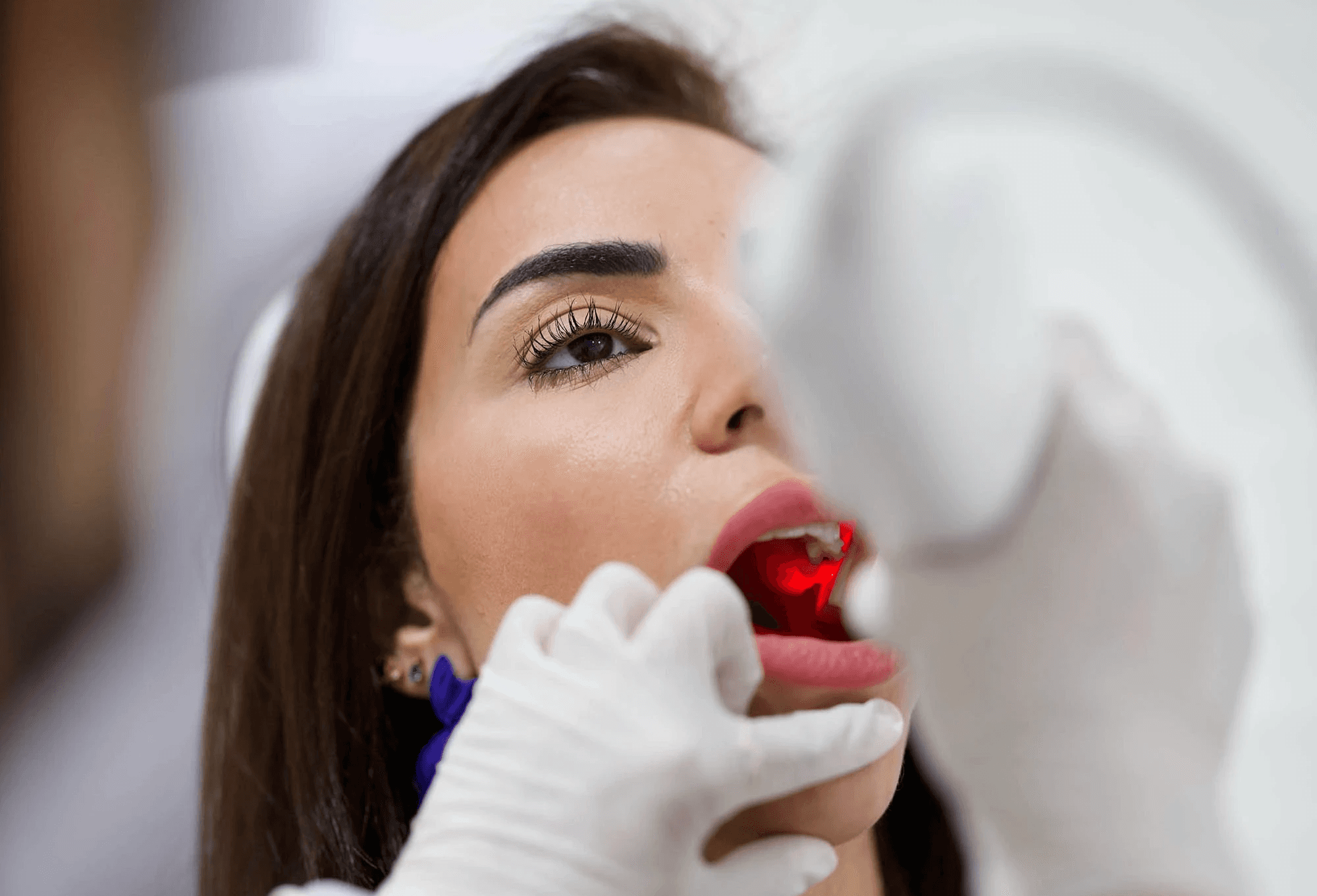 A dentist examining a patient’s teeth for teeth retainer after having braces by Invisalign Center