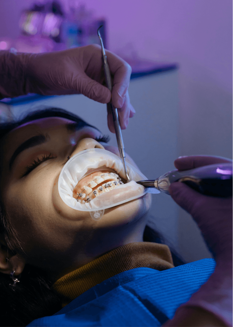 a dentist in davao installing braces to a patient