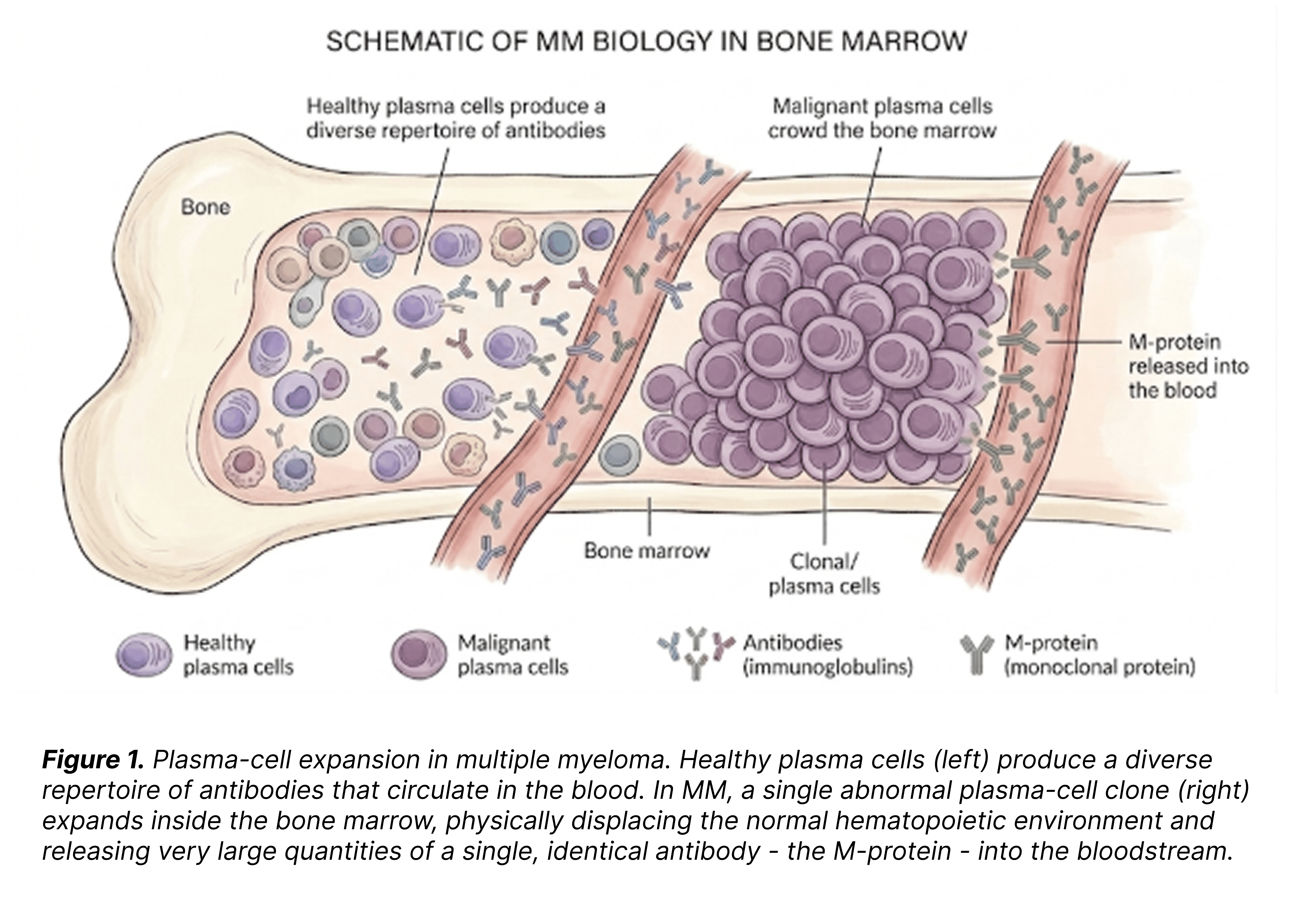 physically crowd the bone marrow