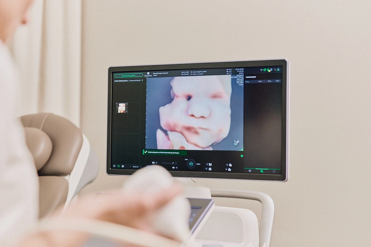 3D-Ultraschall-Bild eines ungeborenen Babys in der Praxis Dr. med. Angela Lauten in Erfurt, spezialisiert auf Pränataldiagnostik, Feindiagnostik, Pränatalmedizin, Frauenheilkunde und Gynäkologie
