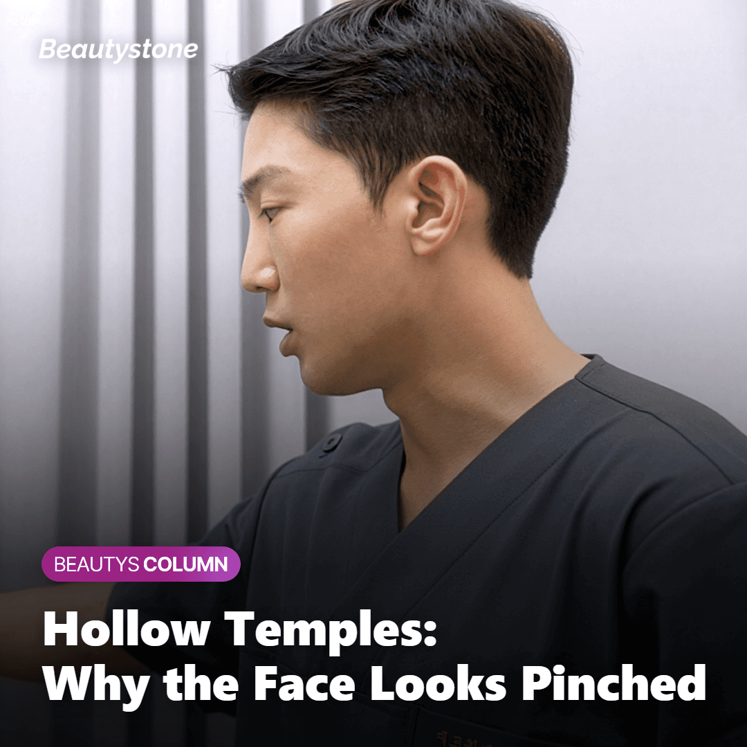 Illustration of hollow temples making the cheekbones appear wider