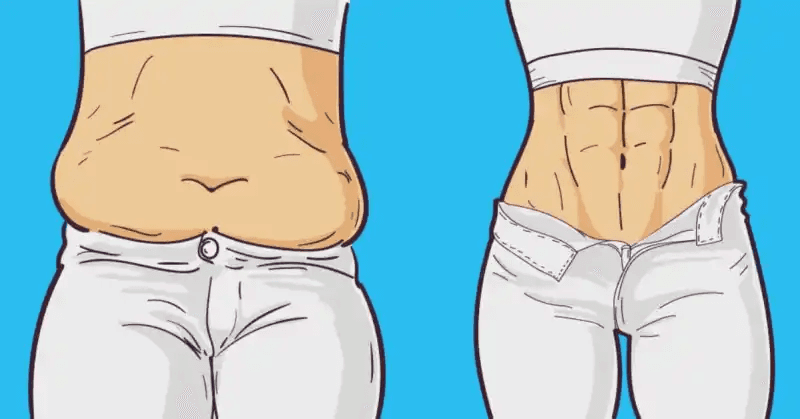 What Is “Liposculpture” (Body Contouring)? How Is It Different from Liposuction?