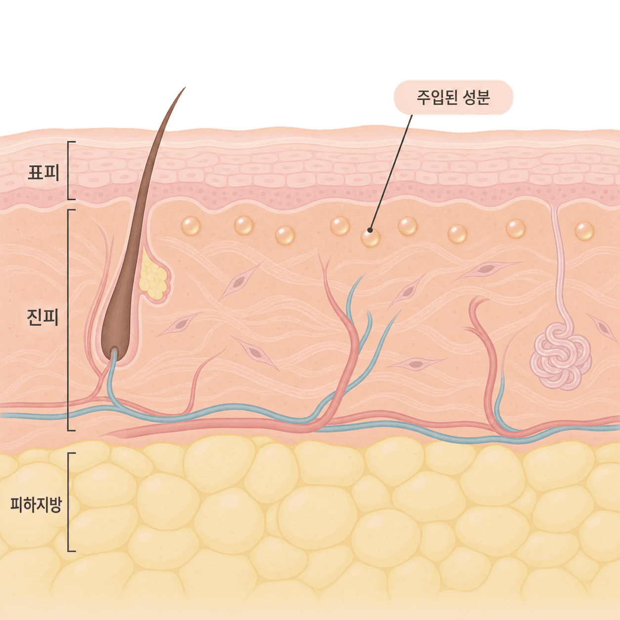 진피 위쪽에 고르게 자리 잡은 스킨부스터 성분의 위치예요
