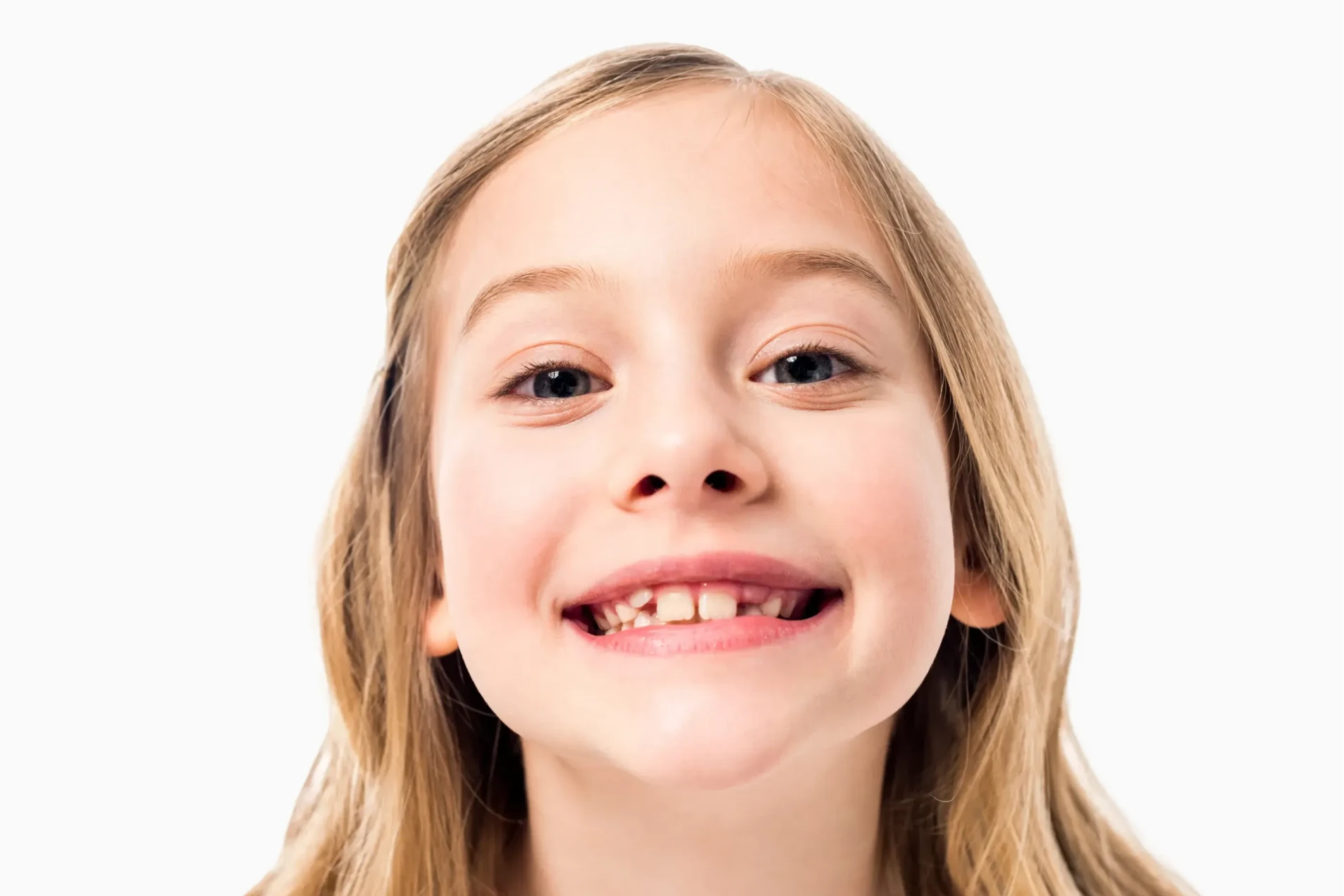 Kobieta z uśmiechem prezentująca efekty bondingu na swoich zębach.