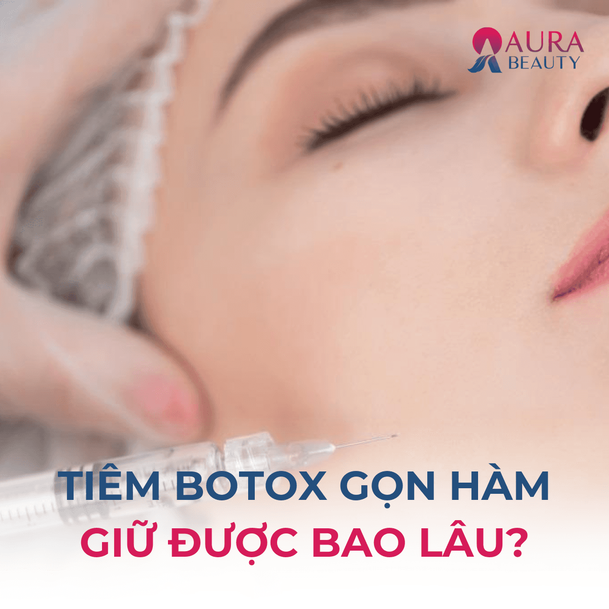 tiêm botox gọn hàm