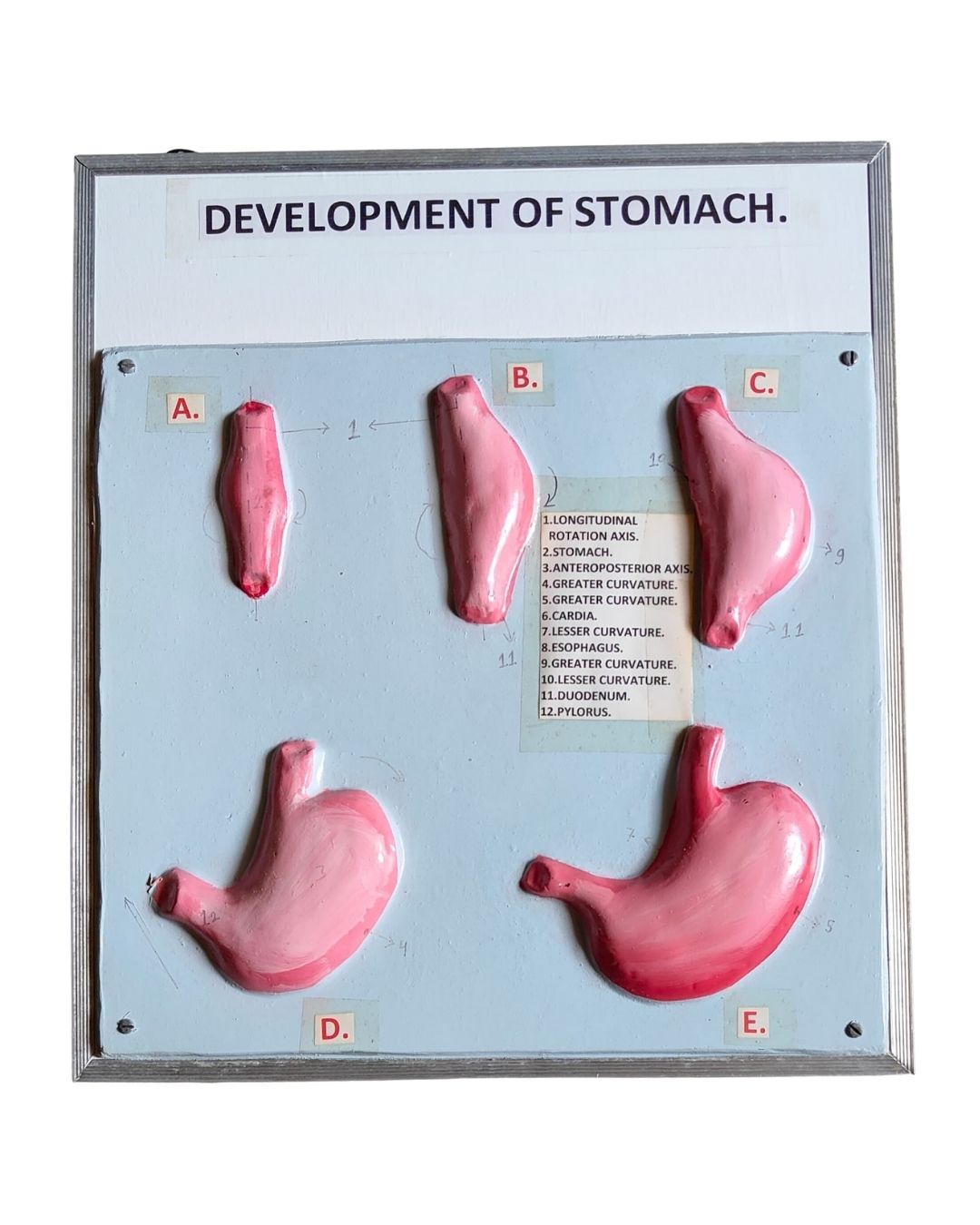 Development of Stomach