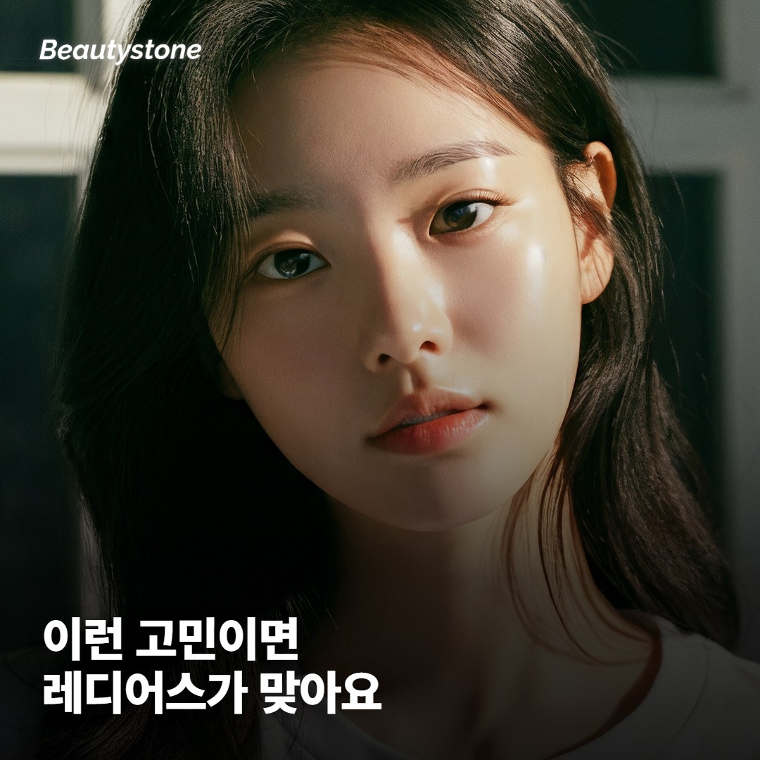 레디어스가 잘 맞는 경우, 미리 상의할 경우