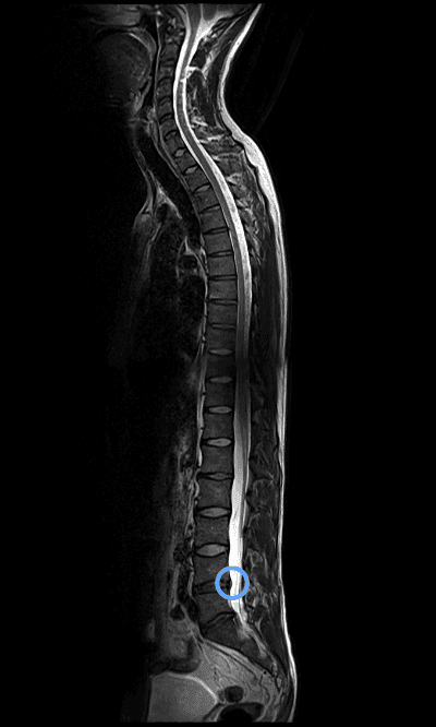 Lower back MRI image scan