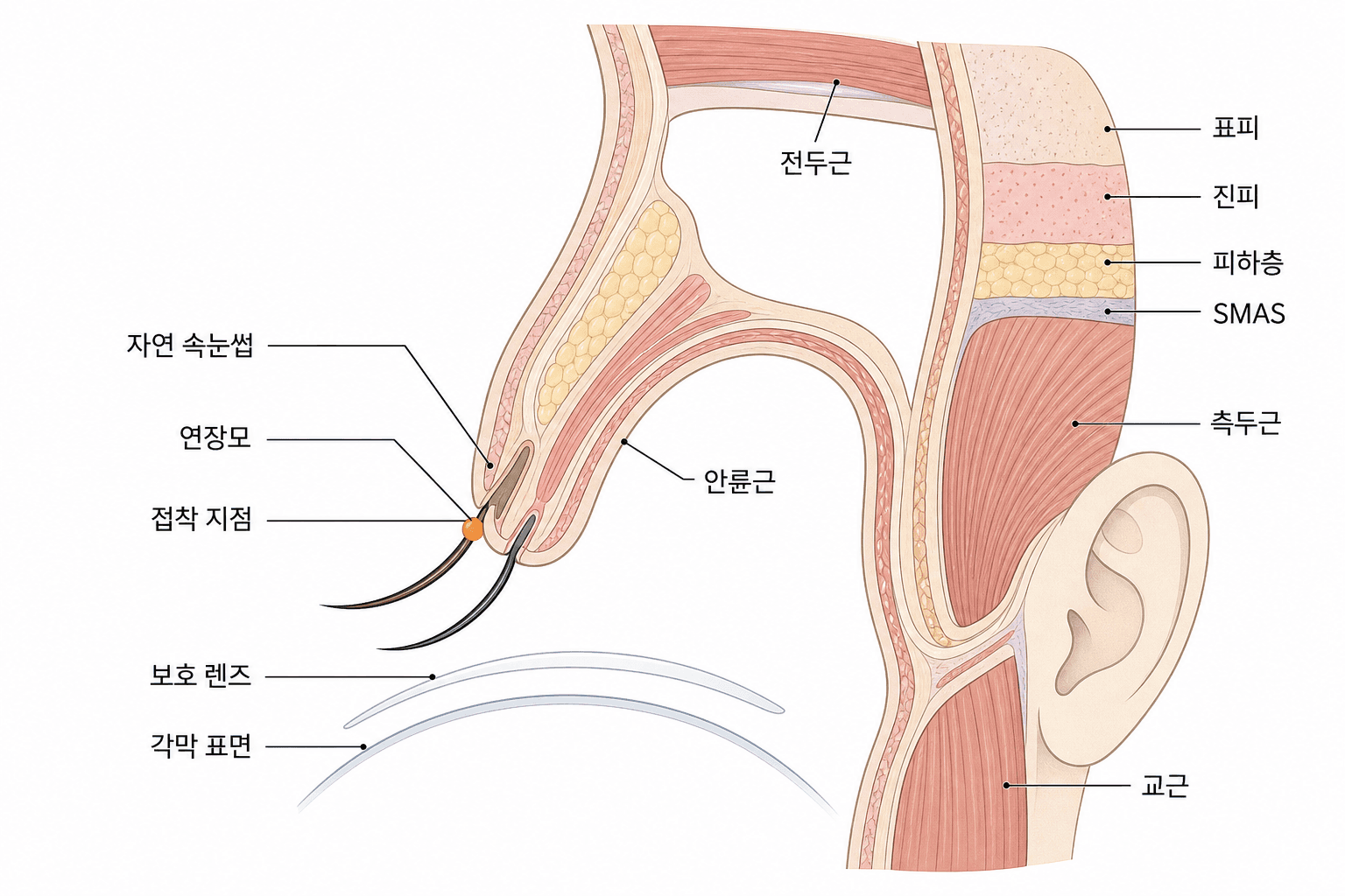 접착 지점은 자연 속눈썹 뿌리 가까이에 있어서 눈가 열과 용제의 영향을 받아요.