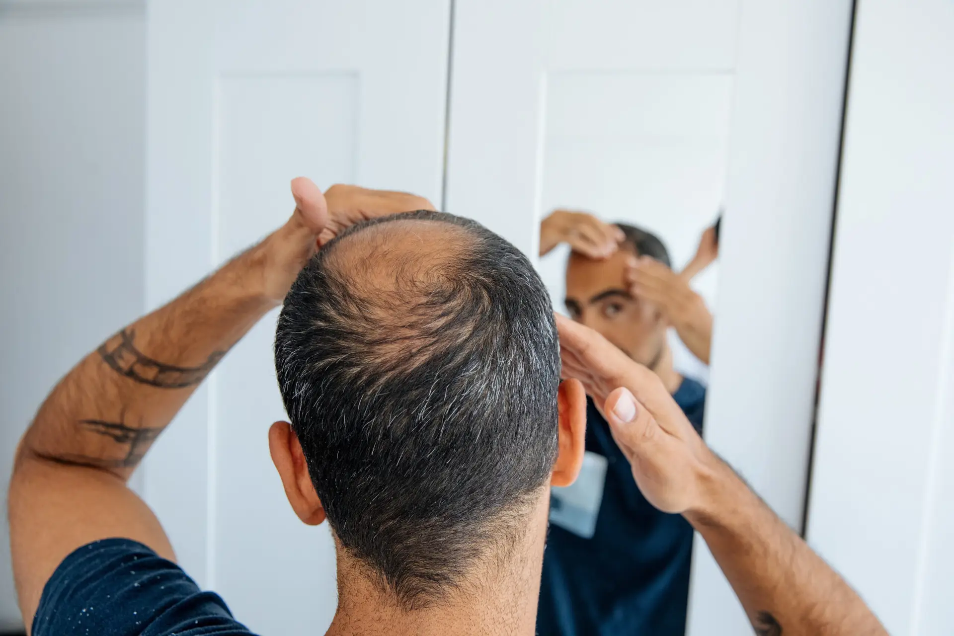 Things Reddit and the NoFap Community Are Saying About Hair Loss