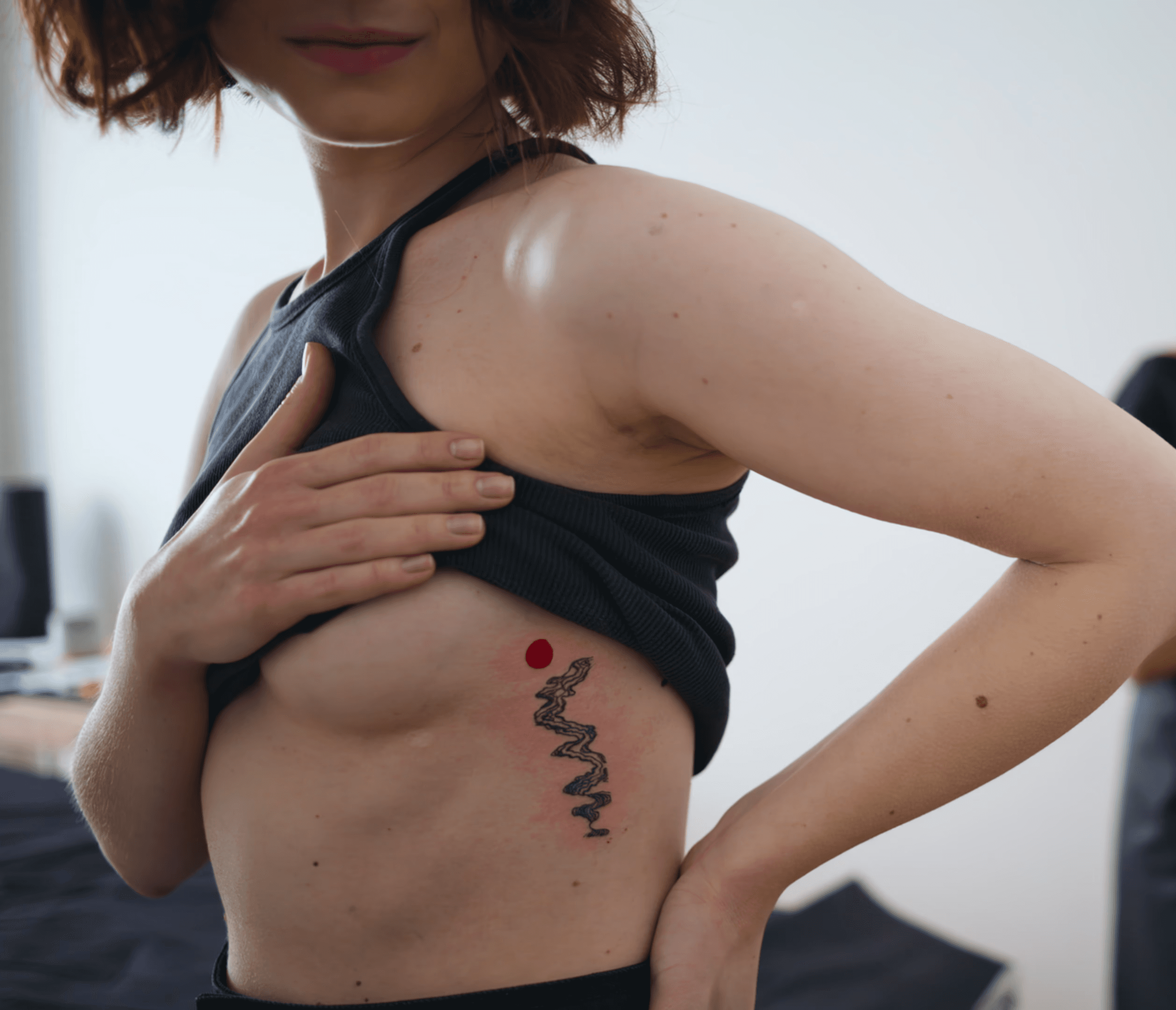 Tattoo Removal for ribcage and chest