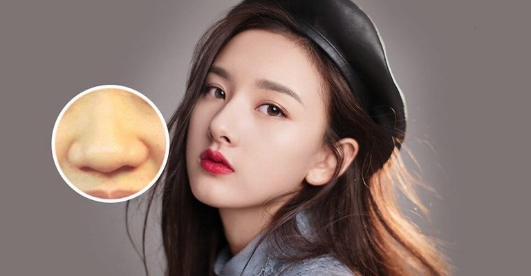Phương pháp thu gọn cánh mũi giúp chị em sở hữu dáng mũi tự nhiên hài hòa