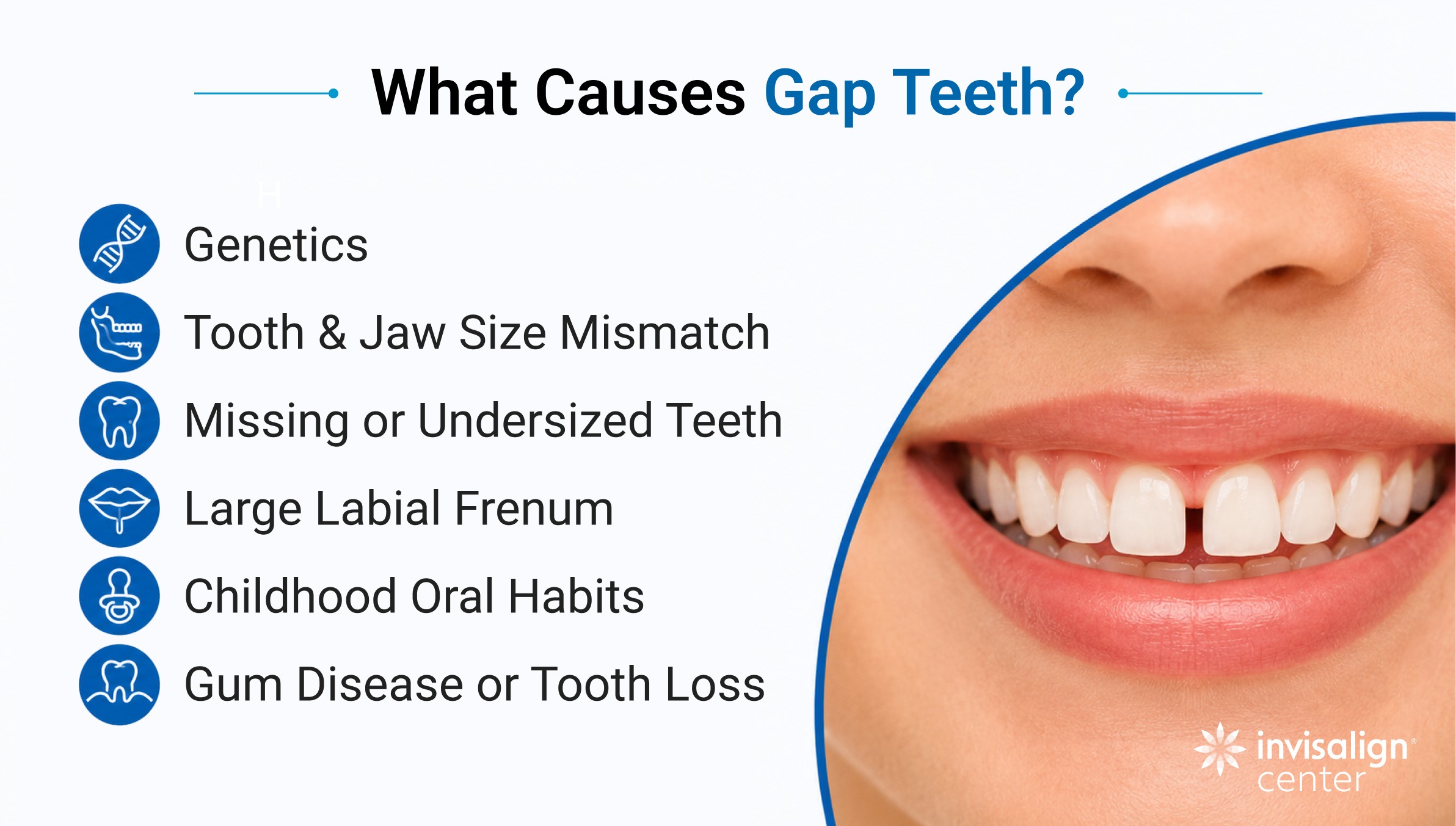 The causes of  gap teeth 