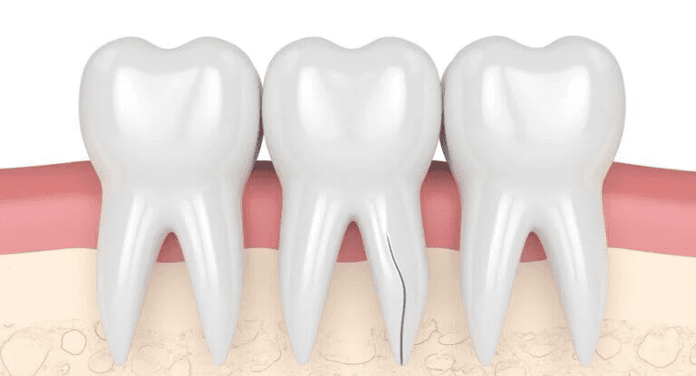 emergency dentist near me