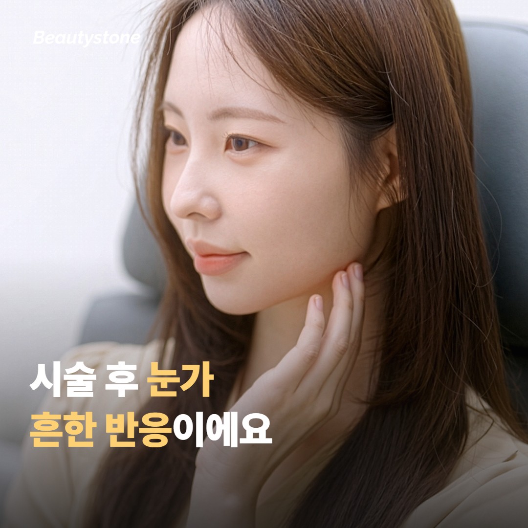 시술 후 눈가에서 흔히 나타나는 반응이에요
