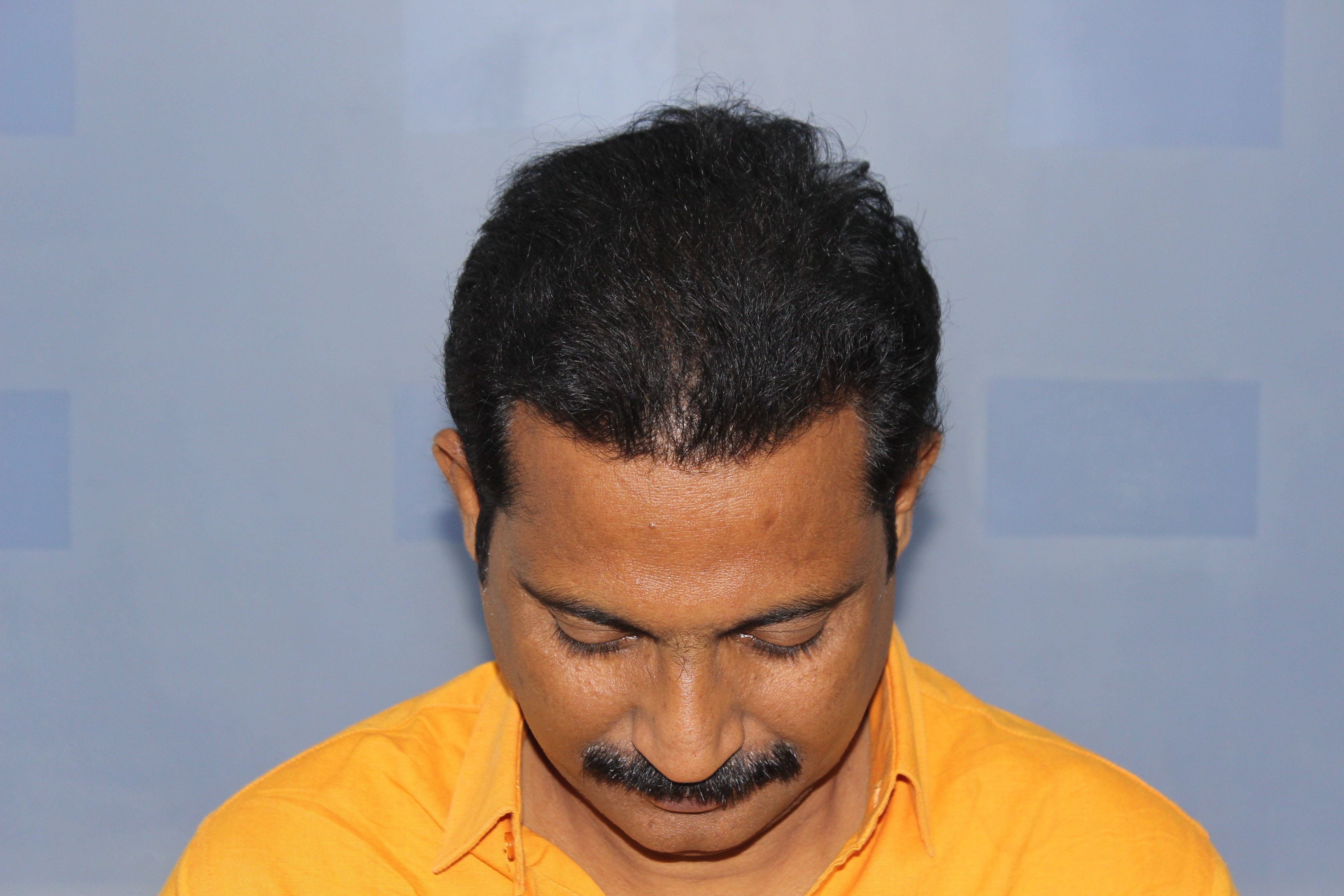 Close-up of mouth with matte mauve lipstick and clean, well-aligned teeth