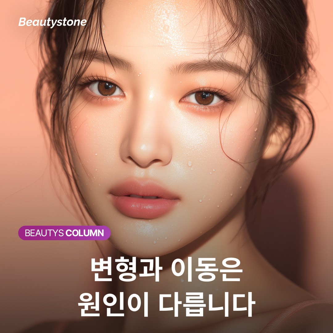 필러 변형과 이동의 차이점, MD코드로 예방하는 3가지 포인트