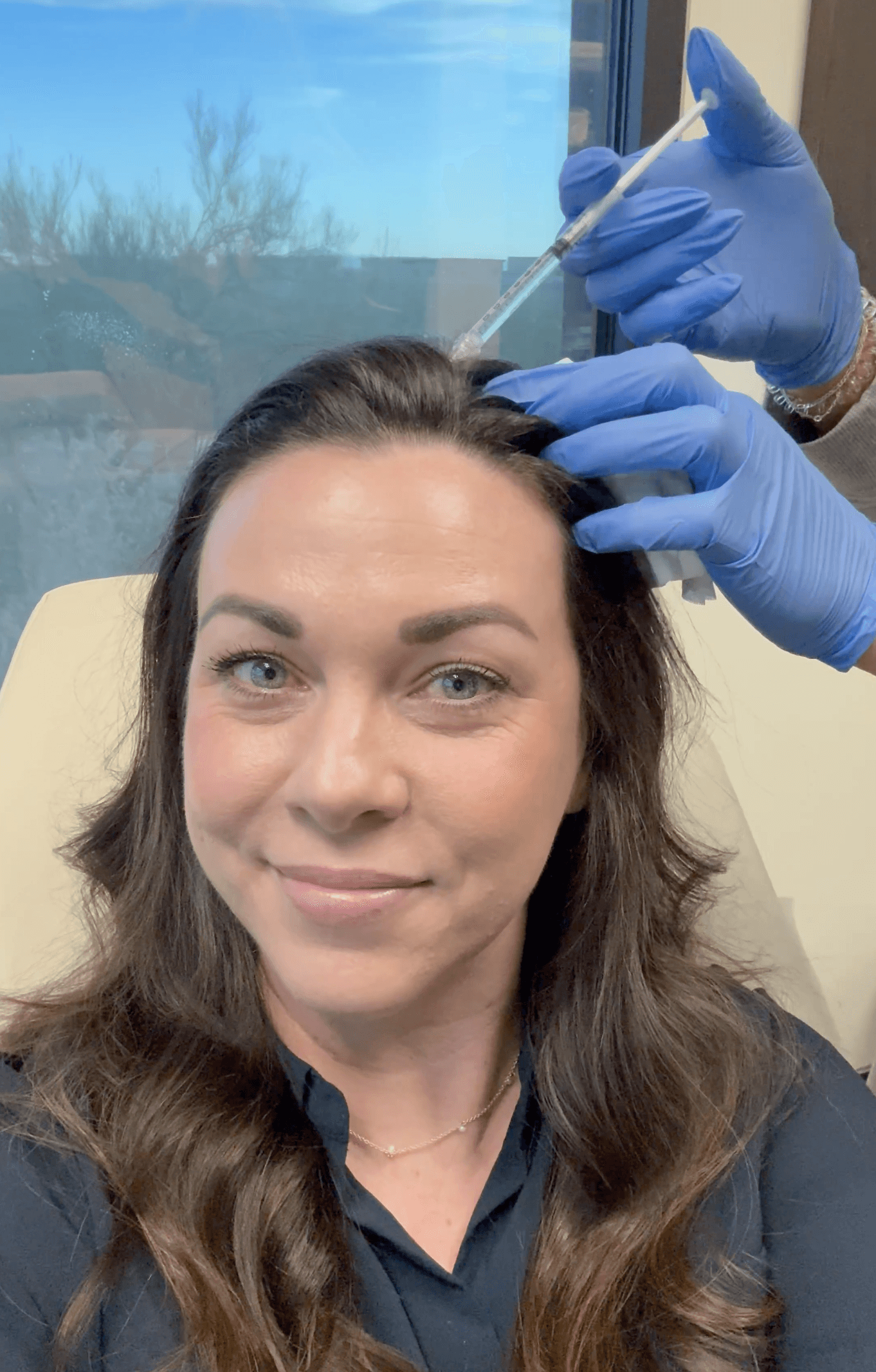 Nova Cell Aesthetics Stem Cell Hair Restoration Photo