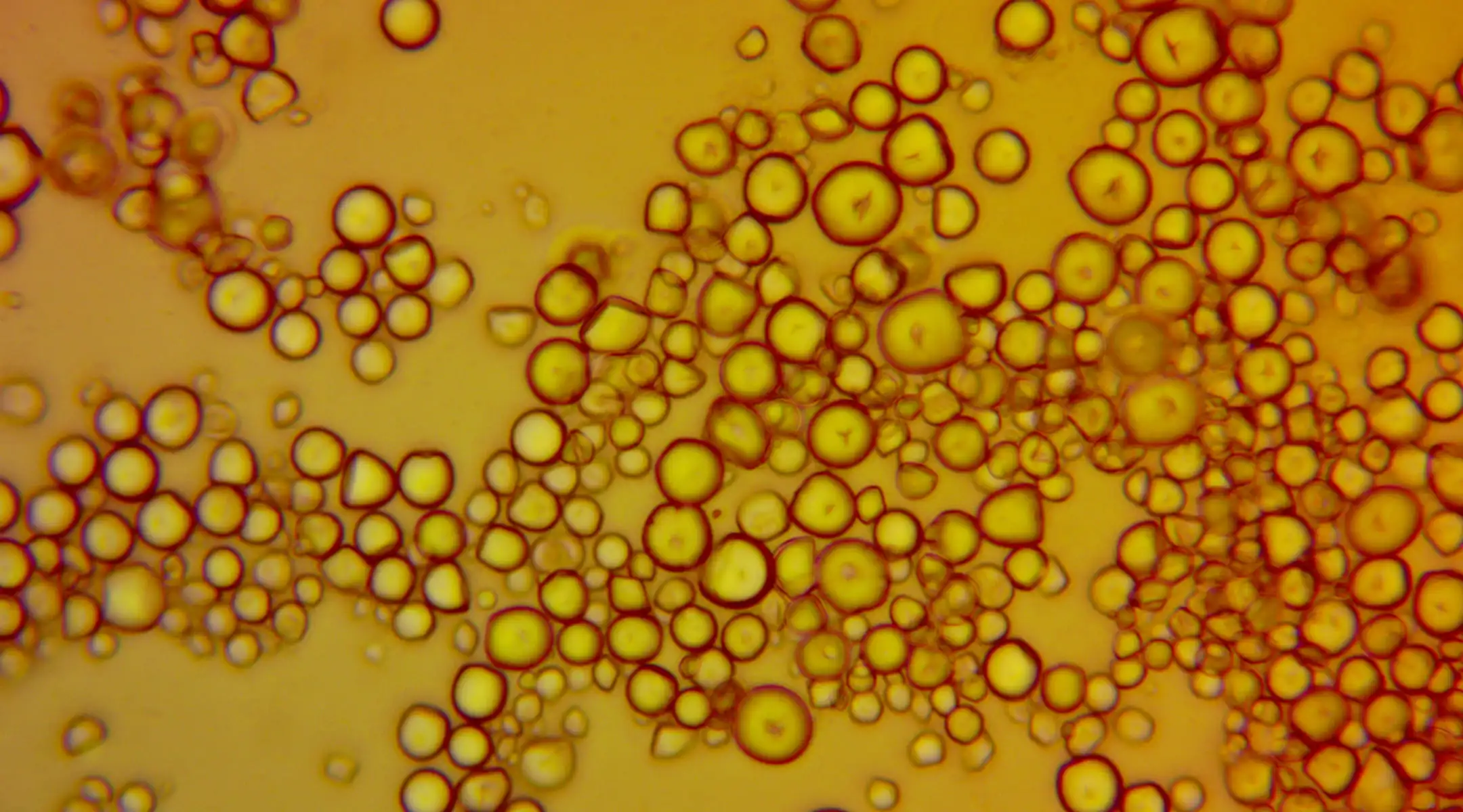 Microscopic view of small, round, yellow-green biological cells clustered together on an amber background.