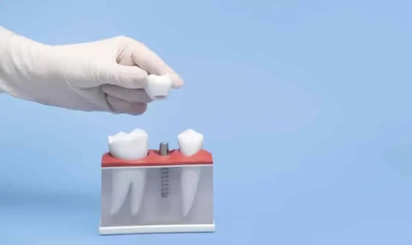 smyrna dental implants