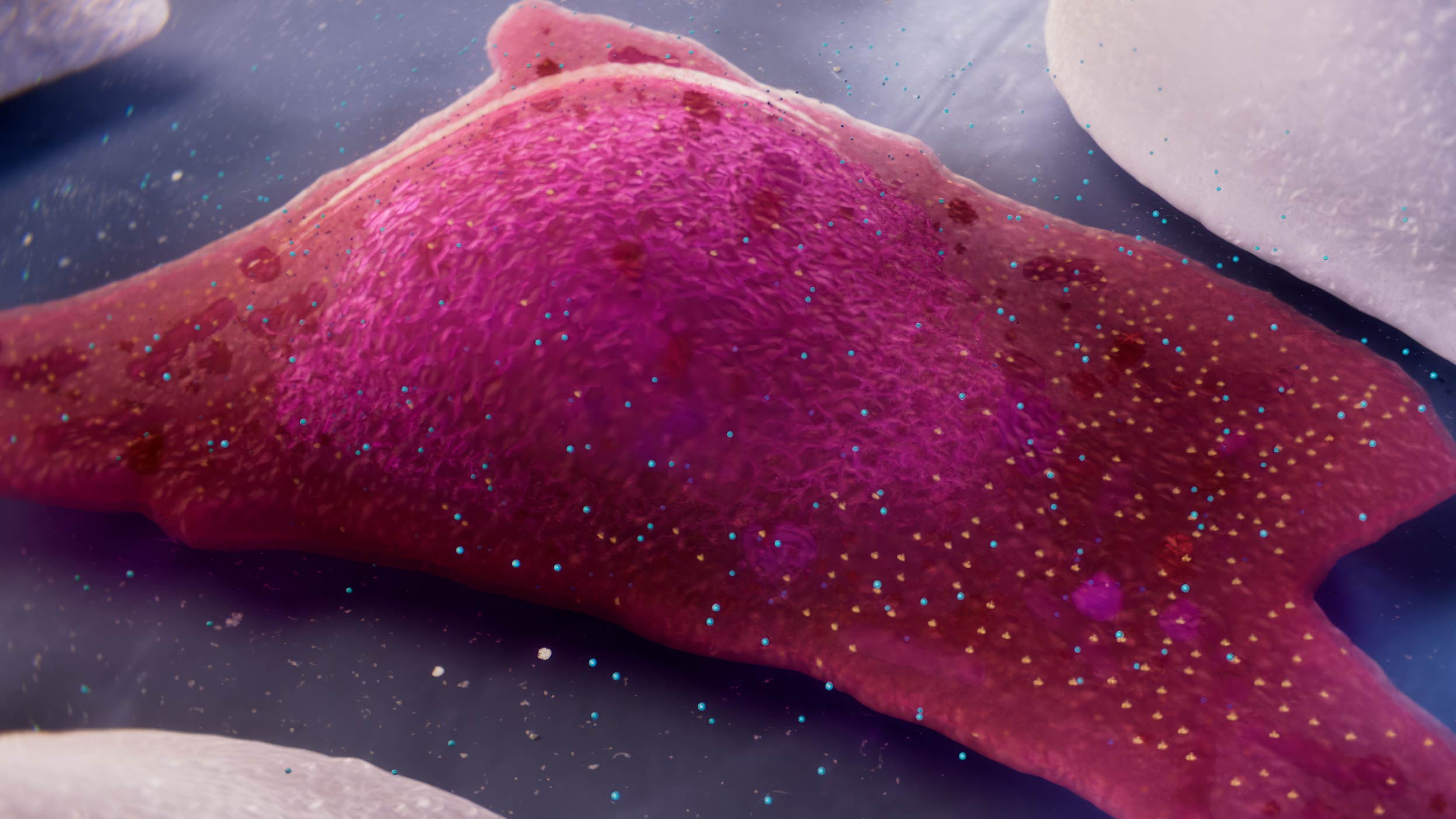 Human cell with abnormal molecular condensates that cause disease