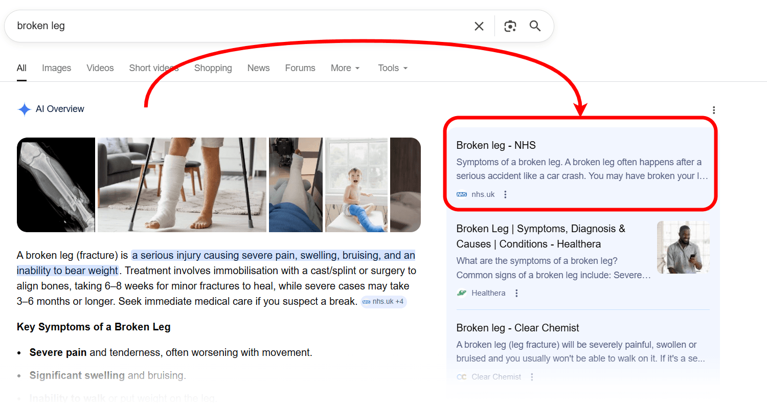 how-to-see-citations-in-aio-summary-in-serp
