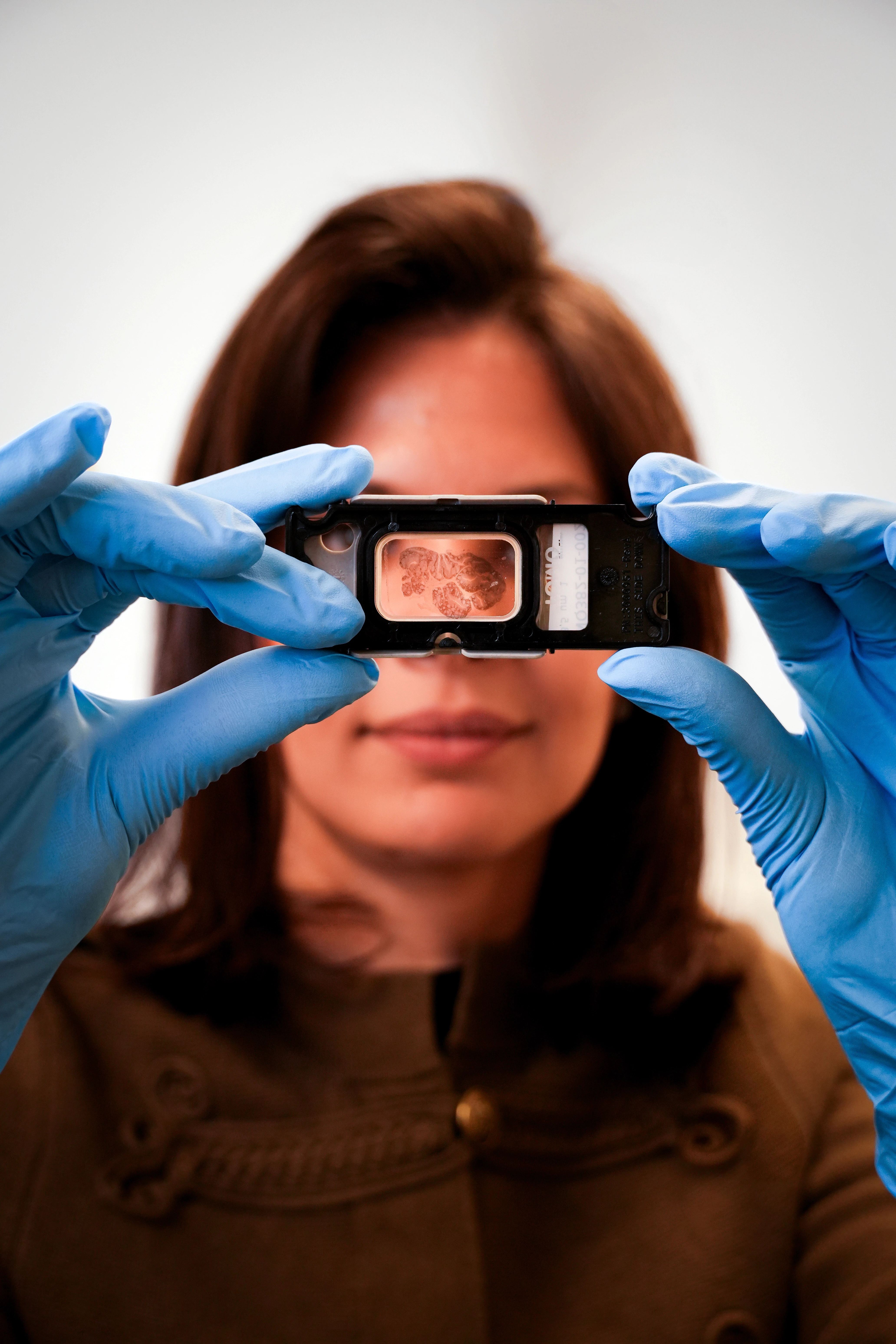 oncology-clinical-trials-patients