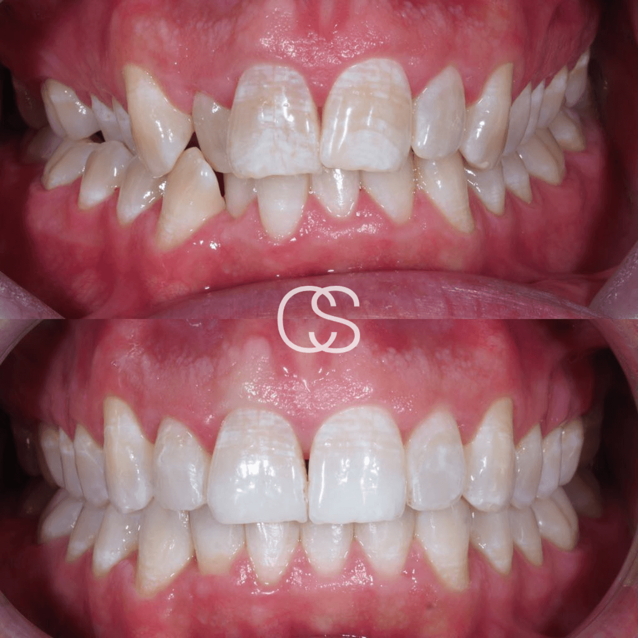 Before & After