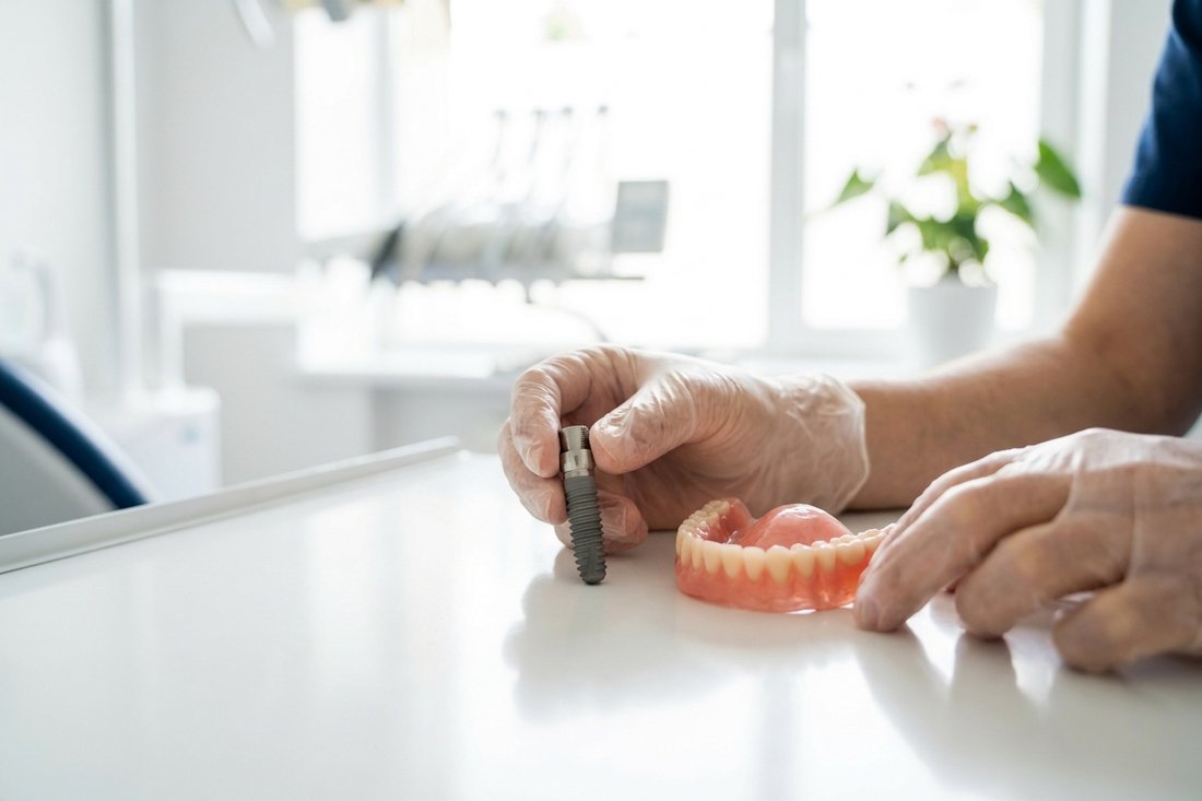 Dentist comparing a dental implant model and a removable denture side by side