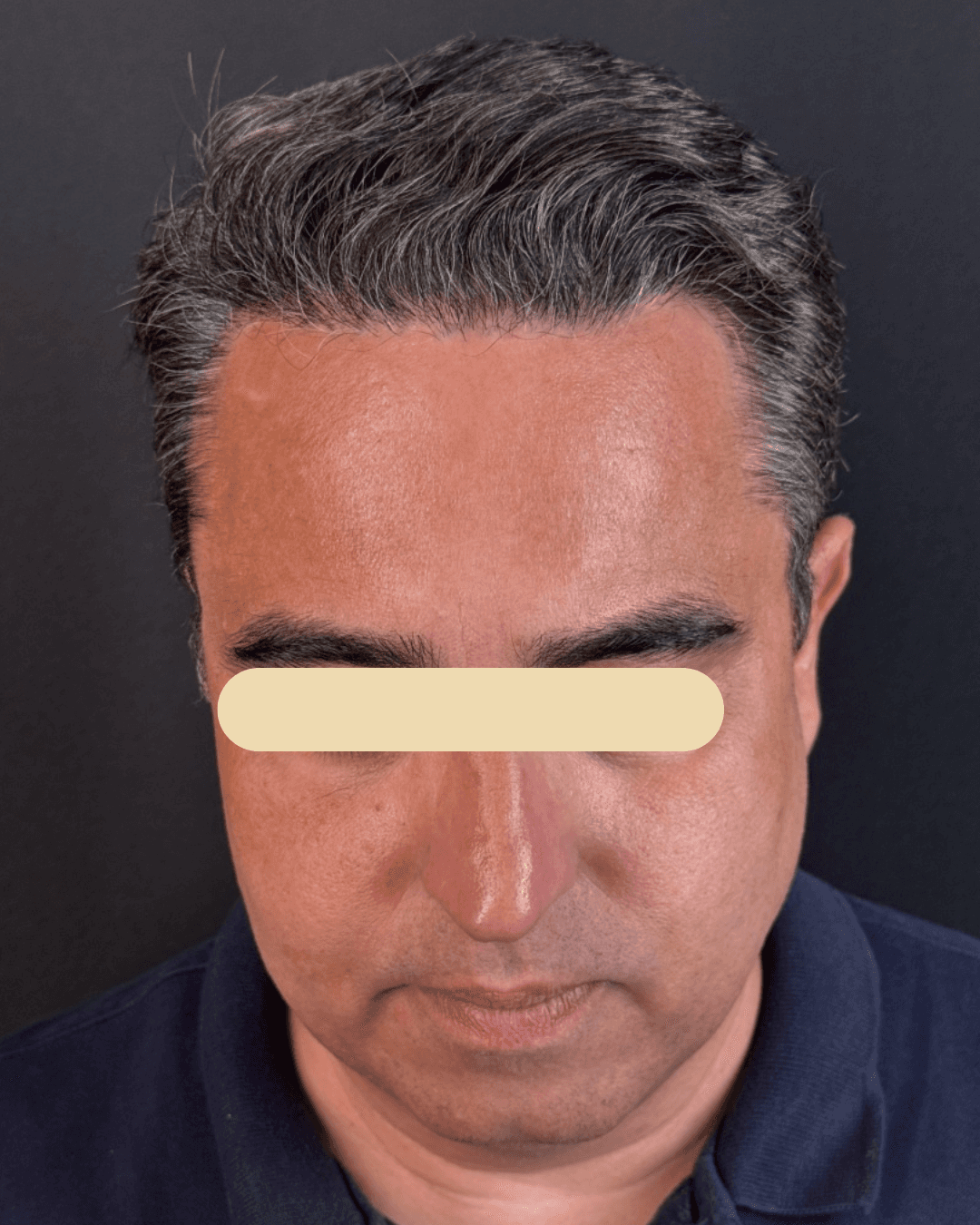 Woman in orange shirt looking up at blue sky