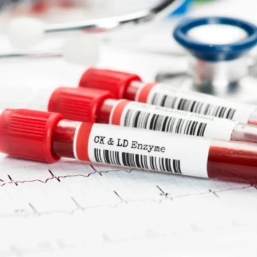 Medical laboratory test tubes and a stethoscope on a clinical table, representing evidence-based medical research in Melbourne.
