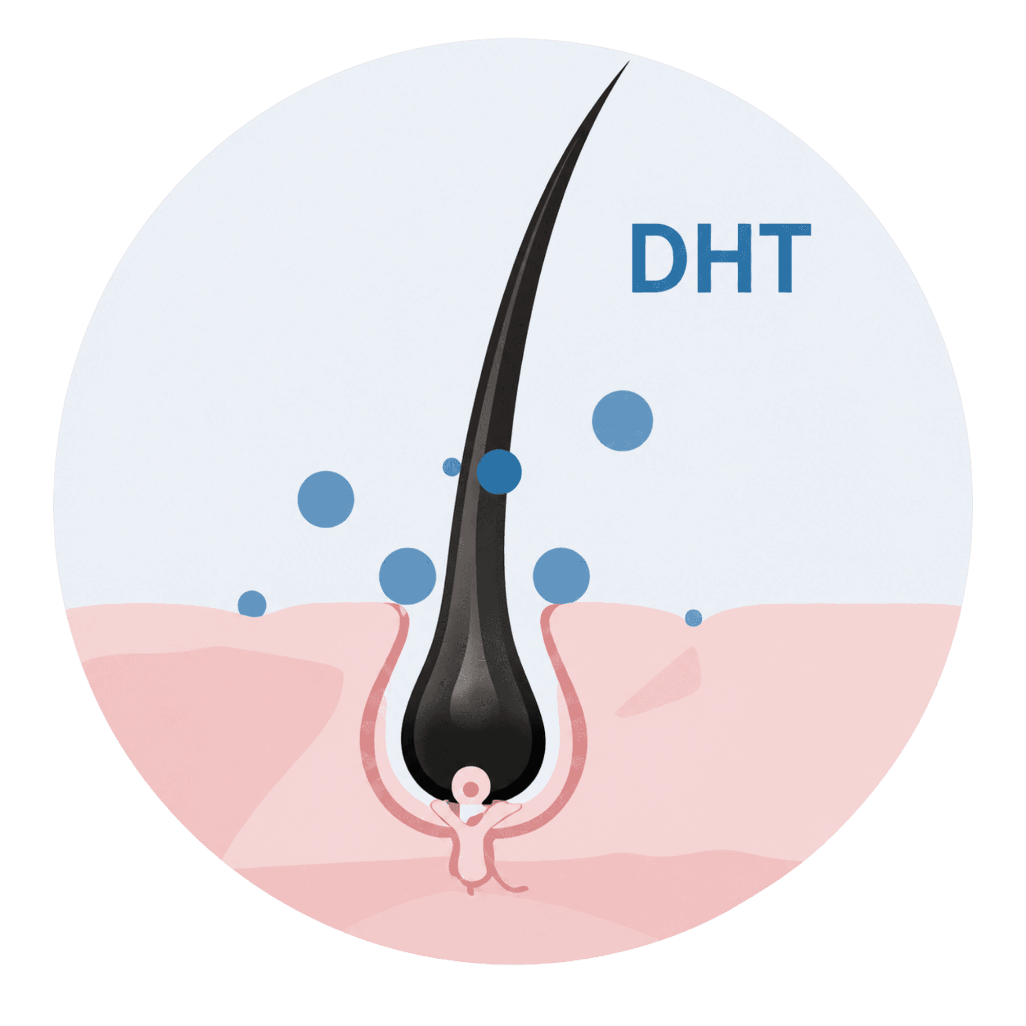 Illustratie van een haarzakje met DHT-invloed bij alopecia androgenetica.