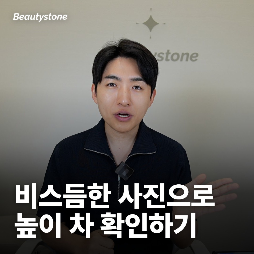 관자 필러 상담에서 무엇을 물어보면 좋아요?