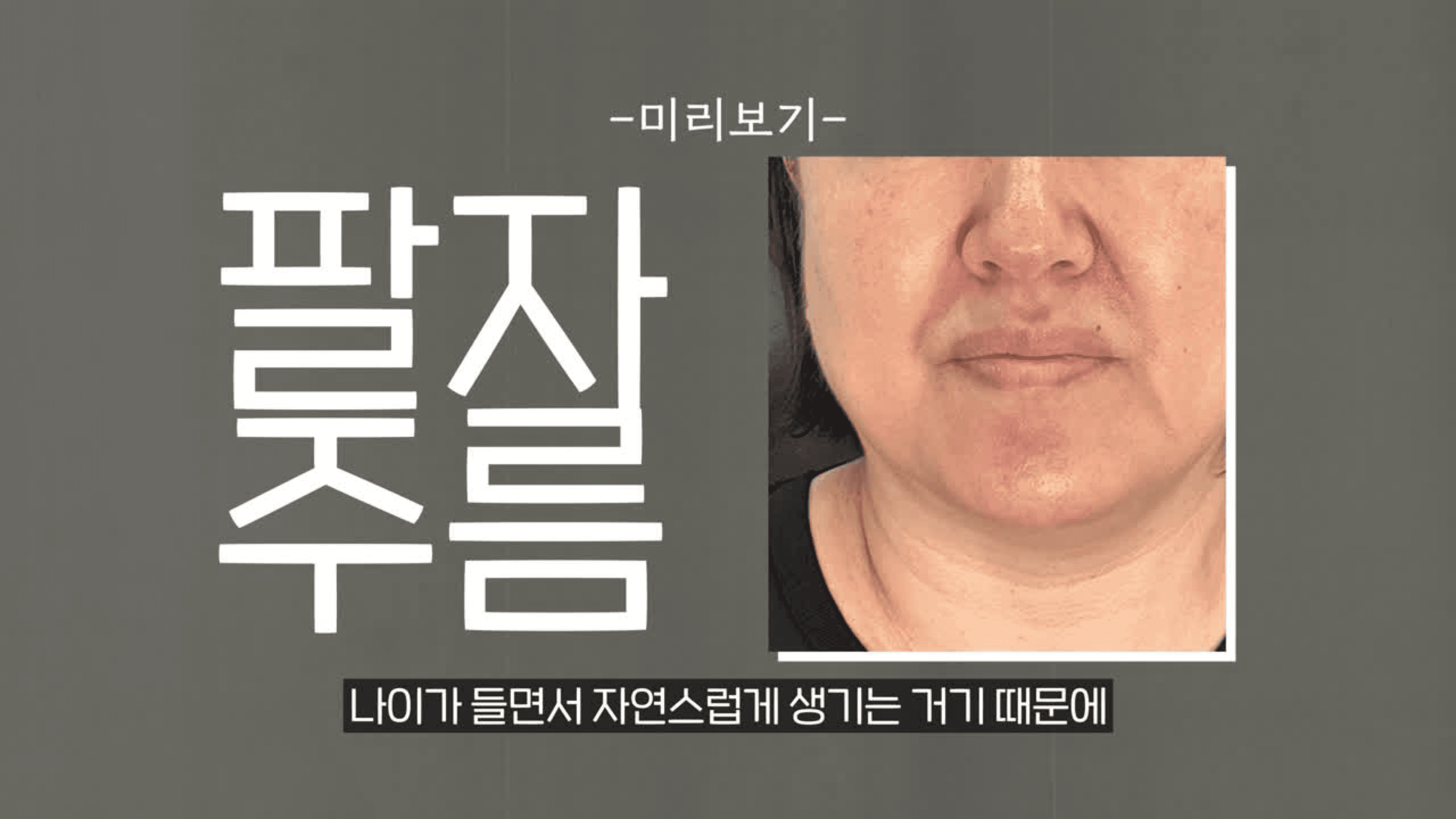 팔자주름 보톡스, '이것' 모르면 평생 후회합니다.