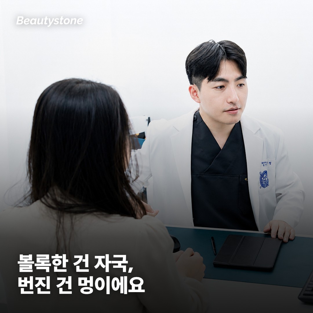 지금 보이는 게 자국인지 멍인지부터 구분해요