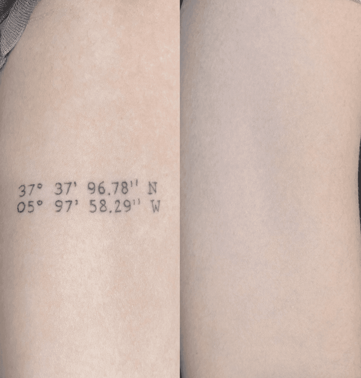 Scalp Micropigmentation Schweiz